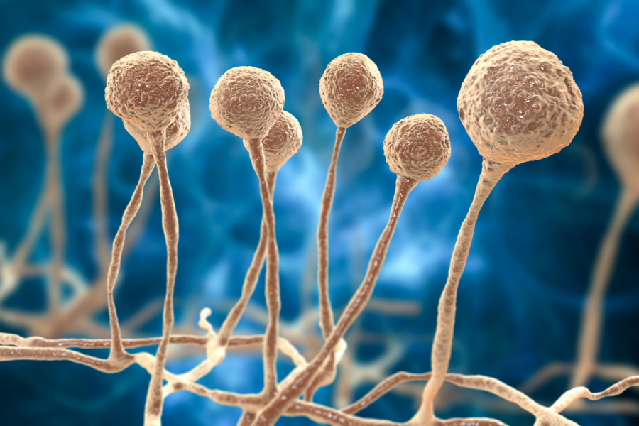 २६ जनामा कालो ढुसीको संक्रमण पुष्टि, औषधि अभावमा उपचारमा समस्या