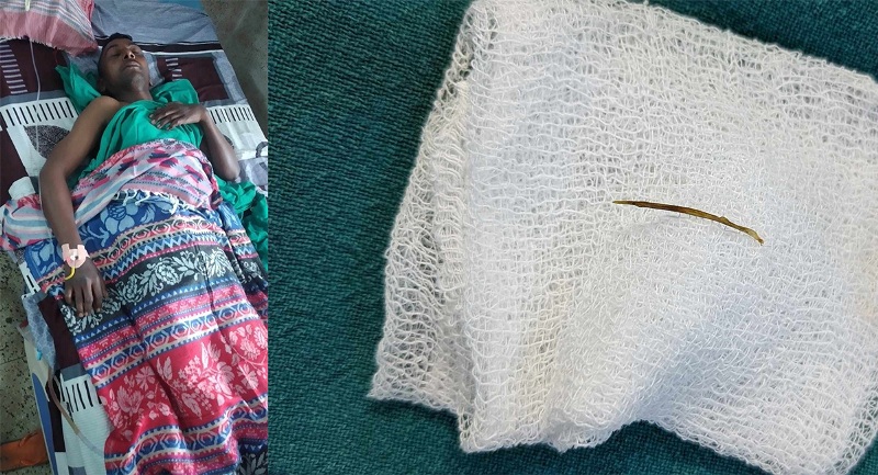 चकित्सकले बिरामीको आन्द्रा भित्रबाट निकाले माछाको काँडा