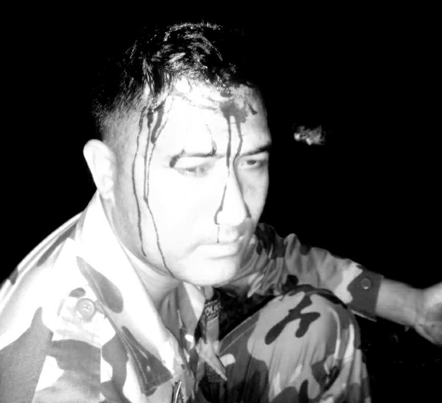 मोरङको रतुवामाईमा सशस्त्र प्रहरीमाथि सीमामा आक्रमण